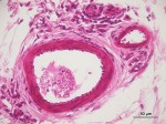 Gânglio linfático - 40x - 3 (vasos do hilo) (editado)(descrição)